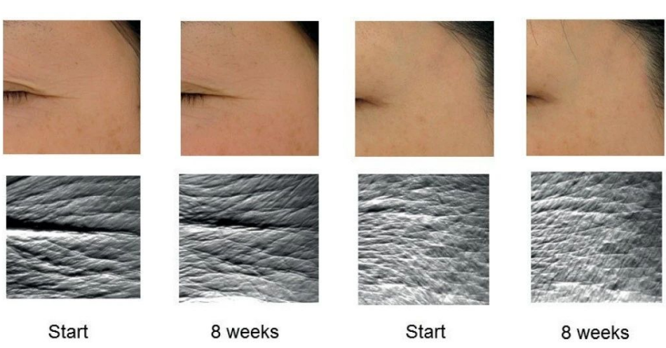 艾詩(shī)特蝦青素