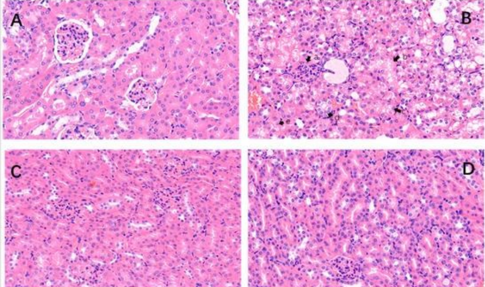 艾詩特蝦青素 艾詩特蝦青素