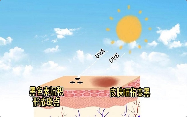 天然蝦青素可以祛斑嗎？